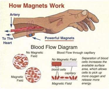 Magneetsieraden - Waarom Energetix kopen